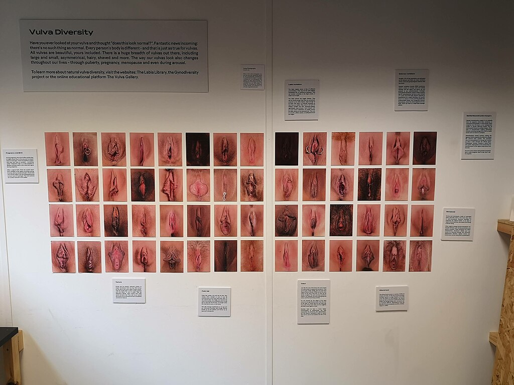 Vulva diversity display in the permanent exhibition at the Vagina Museum at its Victoria Park Square location.